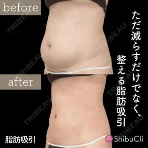渋谷美容外科クリニック 新宿院の症例