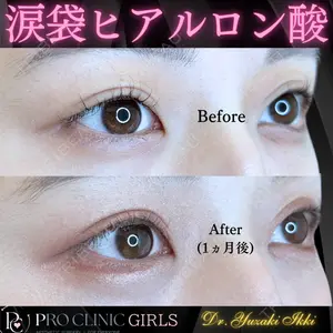 PRO CLINIC プロクリニック 銀座院 柚﨑 一輝医師の症例