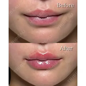 RÉ CLINIQUE SENDAIの症例