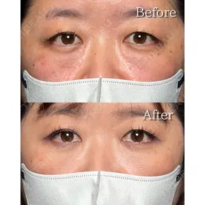 RÉ CLINIQUE SENDAIの症例