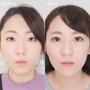 東京イセアクリニック 吉種 克之医師の症例