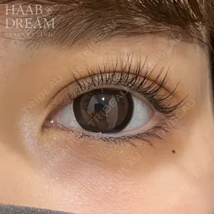 HAAB×DREAM BEAUTY CLINIC 東京本院 田中 優太医師の症例