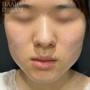 HAAB×DREAM BEAUTY CLINIC 東京本院 田中 優太医師の症例