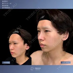 PRISM Beauty Clinic 新宿院 畑山 知輝医師の症例