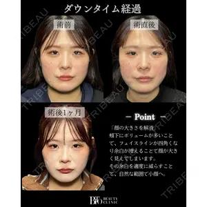 BITO BEAUTY CLINIC 伊藤 富良野医師の症例