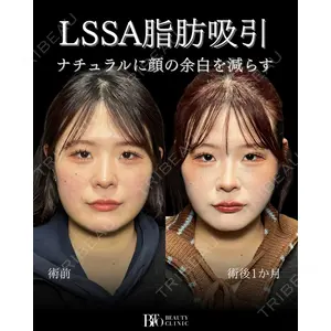 BITO BEAUTY CLINIC 伊藤 富良野医師の症例