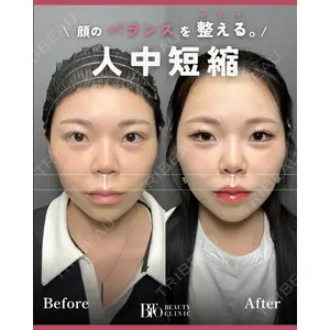 BITO BEAUTY CLINICの症例