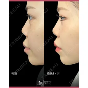 BITO BEAUTY CLINICの症例