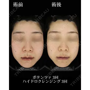 HAAB BEAUTY CLINIC 名古屋院の症例