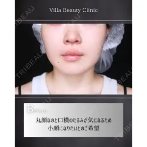 博多美容外科/美容皮膚科 ビラビューティークリニック 大村 亞蘭医師の症例