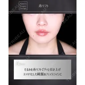 博多美容外科/美容皮膚科 ビラビューティークリニック 大村 亞蘭医師の症例