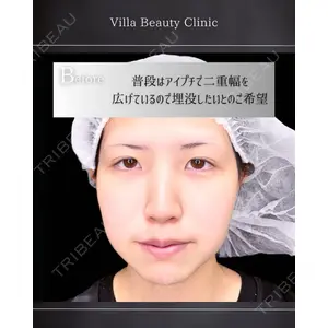 博多美容外科/美容皮膚科 ビラビューティークリニック 大村 亞蘭医師の症例