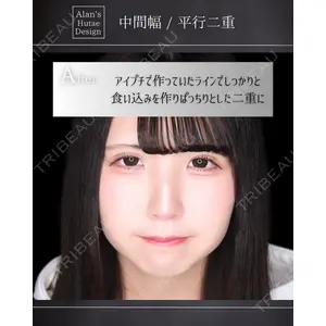 博多美容外科/美容皮膚科 ビラビューティークリニック 大村 亞蘭医師の症例