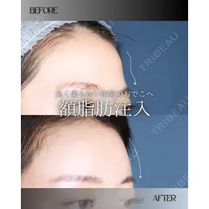 博多美容外科/美容皮膚科 ビラビューティークリニック 大村 亞蘭医師の症例