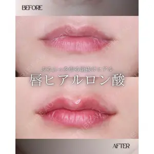 博多美容外科/美容皮膚科 ビラビューティークリニック 大村 亞蘭医師の症例