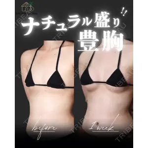 博多美容外科/美容皮膚科 ビラビューティークリニック 大村 亞蘭医師の症例