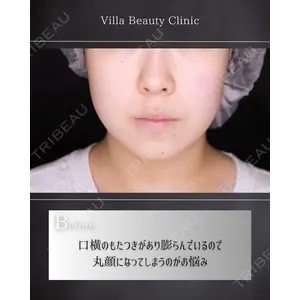 博多美容外科/美容皮膚科 ビラビューティークリニック 大村 亞蘭医師の症例