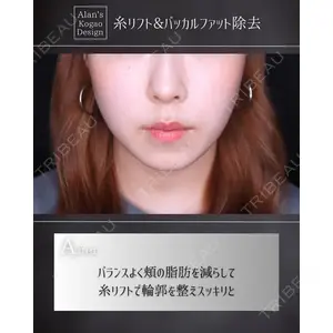 博多美容外科/美容皮膚科 ビラビューティークリニック 大村 亞蘭医師の症例