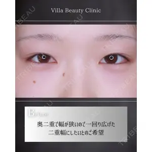 博多美容外科/美容皮膚科 ビラビューティークリニック 大村 亞蘭医師の症例