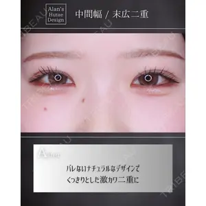 博多美容外科/美容皮膚科 ビラビューティークリニック 大村 亞蘭医師の症例