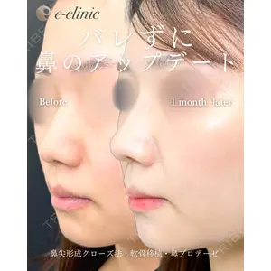 eクリニック 福岡院 伊藤 渉医師の症例