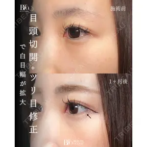 BITO BEAUTY CLINIC 伊藤 富良野医師の症例