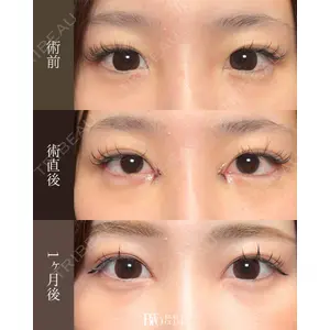 BITO BEAUTY CLINIC 伊藤 富良野医師の症例