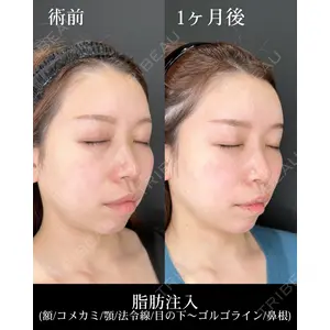 HAAB×DREAM BEAUTY CLINIC 大阪梅田院 鈴木 馨斗医師の症例