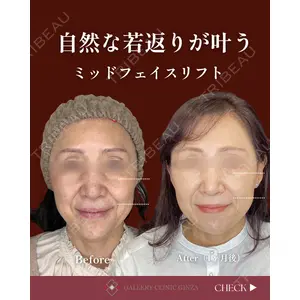 ギャラリークリニック 銀座 中川剛医師の症例