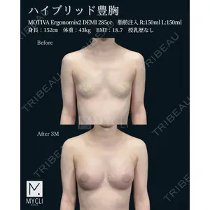 MYCLI【マイクリ】大阪・梅田院 三木 晶森医師の症例