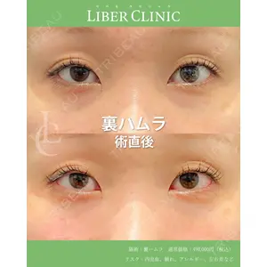 LIBER CLINIC 矢橋 洋一郎医師の症例