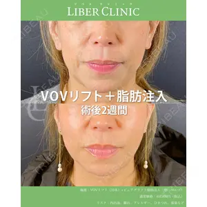 LIBER CLINIC 矢橋 洋一郎医師の症例