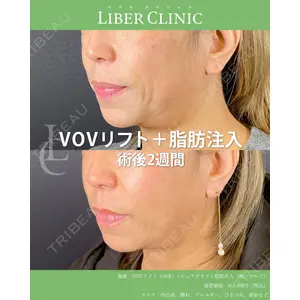 LIBER CLINIC 矢橋 洋一郎医師の症例