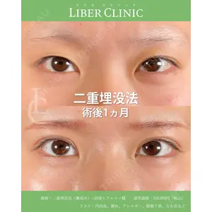 LIBER CLINIC 矢橋 洋一郎医師の症例