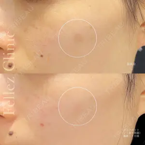 Fellez Clinic【フェルズクリニック】の症例