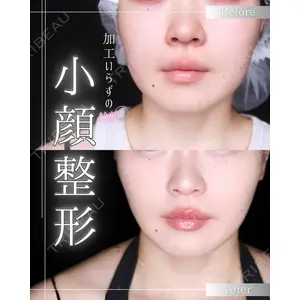 博多美容外科/美容皮膚科 ビラビューティークリニック 大村 亞蘭医師の症例