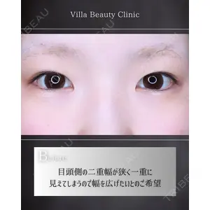 博多美容外科/美容皮膚科 ビラビューティークリニック 大村 亞蘭医師の症例