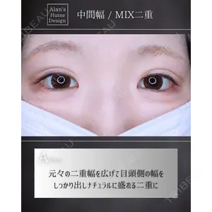 博多美容外科/美容皮膚科 ビラビューティークリニック 大村 亞蘭医師の症例