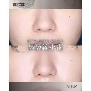 博多美容外科/美容皮膚科 ビラビューティークリニック 大村 亞蘭医師の症例