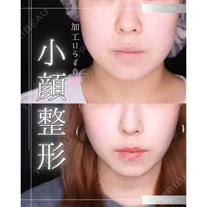 博多美容外科/美容皮膚科 ビラビューティークリニック 大村 亞蘭医師の症例