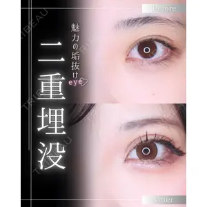 博多美容外科/美容皮膚科 ビラビューティークリニック 大村 亞蘭医師の症例