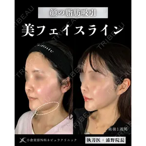 小倉美容外科ネビュラクリニック 浦野 正樹医師の症例