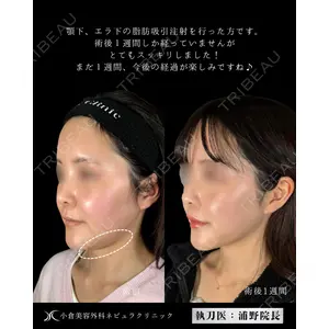 小倉美容外科ネビュラクリニック 浦野 正樹医師の症例