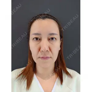 HAAB BEAUTY CLINIC 南青山本院（新院） 小平 佳典医師の症例