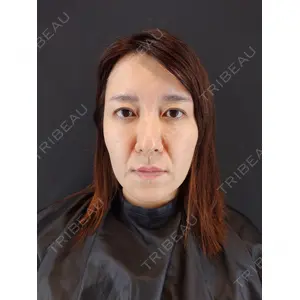 HAAB BEAUTY CLINIC 南青山本院（新院） 小平 佳典医師の症例