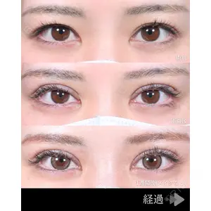 東京シンデレラ美容外科 池袋院 石井 達也医師の症例