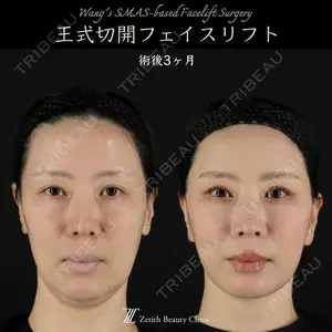 Zetith Beauty Clinic 新宿院 王 蘇医師の症例