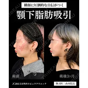 新宿美容外科ネビュラクリニック 山本 紘子医師の症例