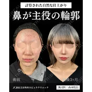 新宿美容外科ネビュラクリニック 山本 紘子医師の症例