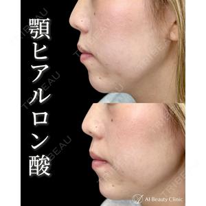 AI Beauty Clinic （エーアイ美容クリニック） 田中 里佳医師の症例